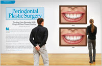 periodontal-plastic-surgery-dear-doctor